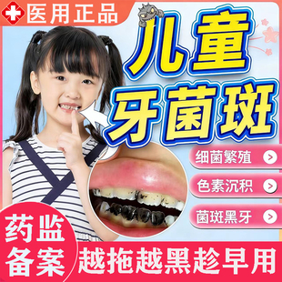 儿童去牙菌斑牙膏牙齿黑色素沉淀黑斑去除黑牙祛除污垢美白神器LL
