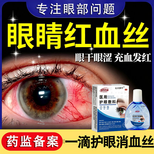 缓解眼疲劳干眼涩视力模糊不清