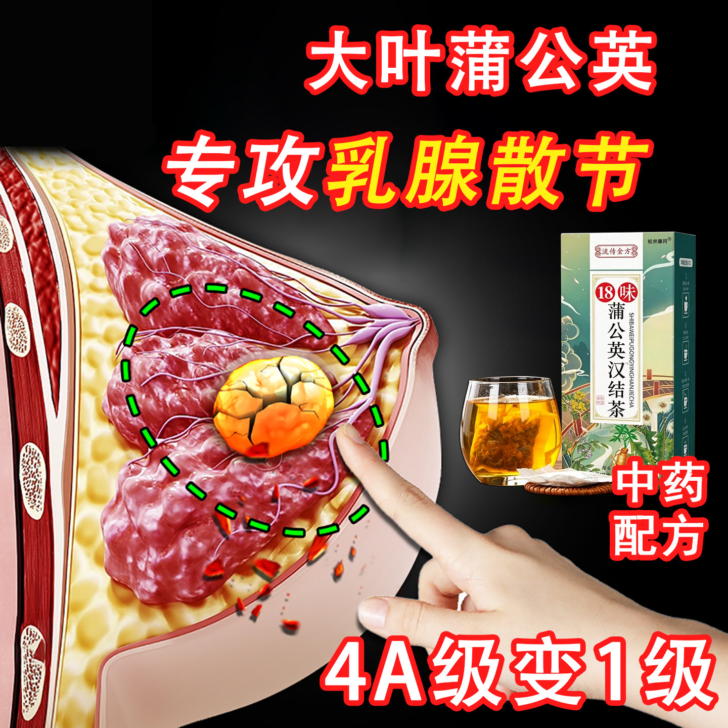 蒲公英散结茶疏通散结硬块囊肿散结乳腺增生乳房胀痛药医用正品JN