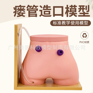 瘘管造口术护理模型 造瘘练习模型 结肠造口 回肠造瘘模型