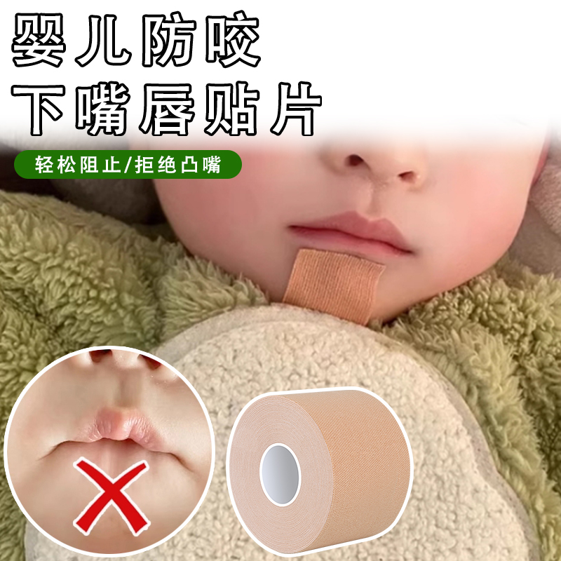 米乐奇宝宝防吸防咬下嘴唇胶贴片
