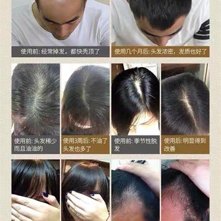 现货速发【不长我吃掉】头发自然生长速度 男头发速度变密