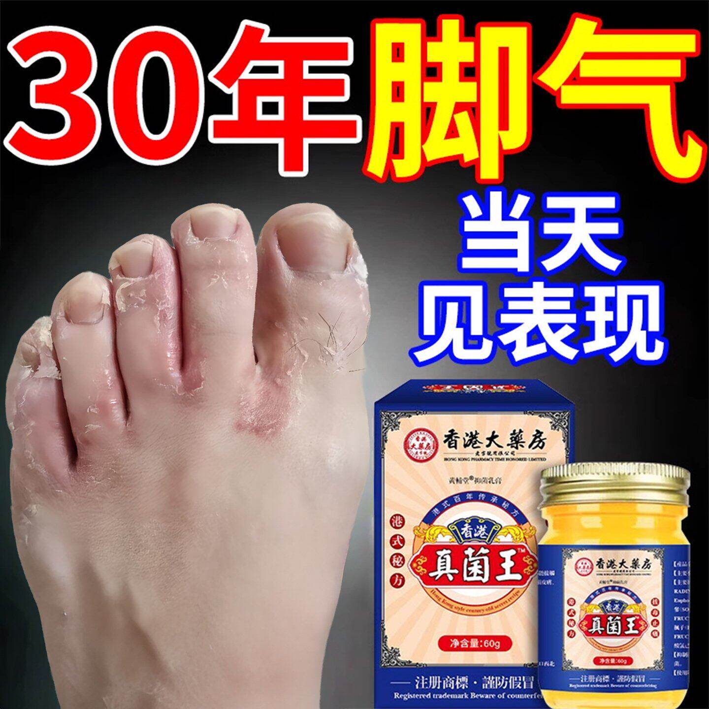 香港药房真菌王脚气膏脱皮