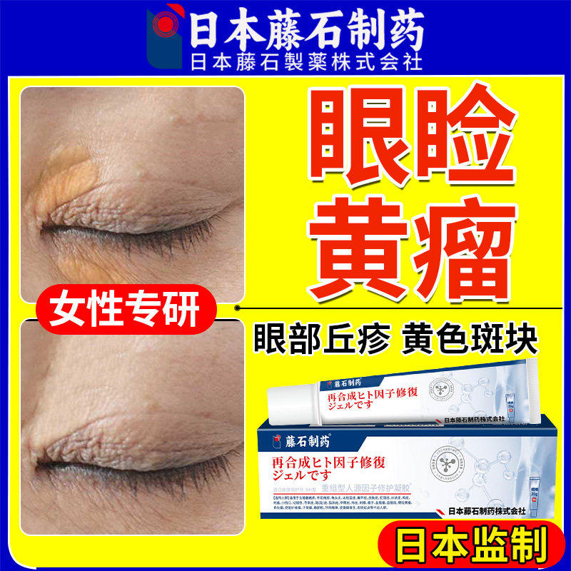 眼睑黄瘤专用去周汗管脂肪