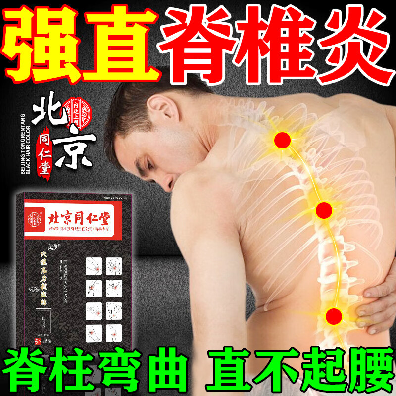 北京同仁堂强直性脊柱炎专