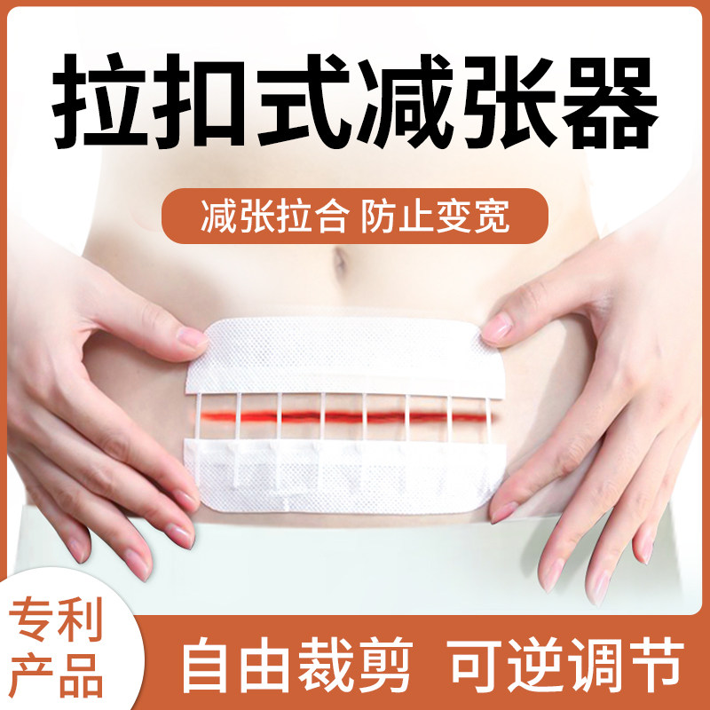 医用拉链式减张器剖腹产手