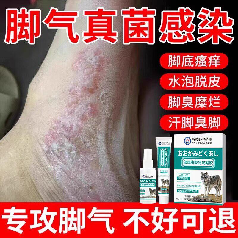 脚气喷雾止脱皮痒杀菌去真