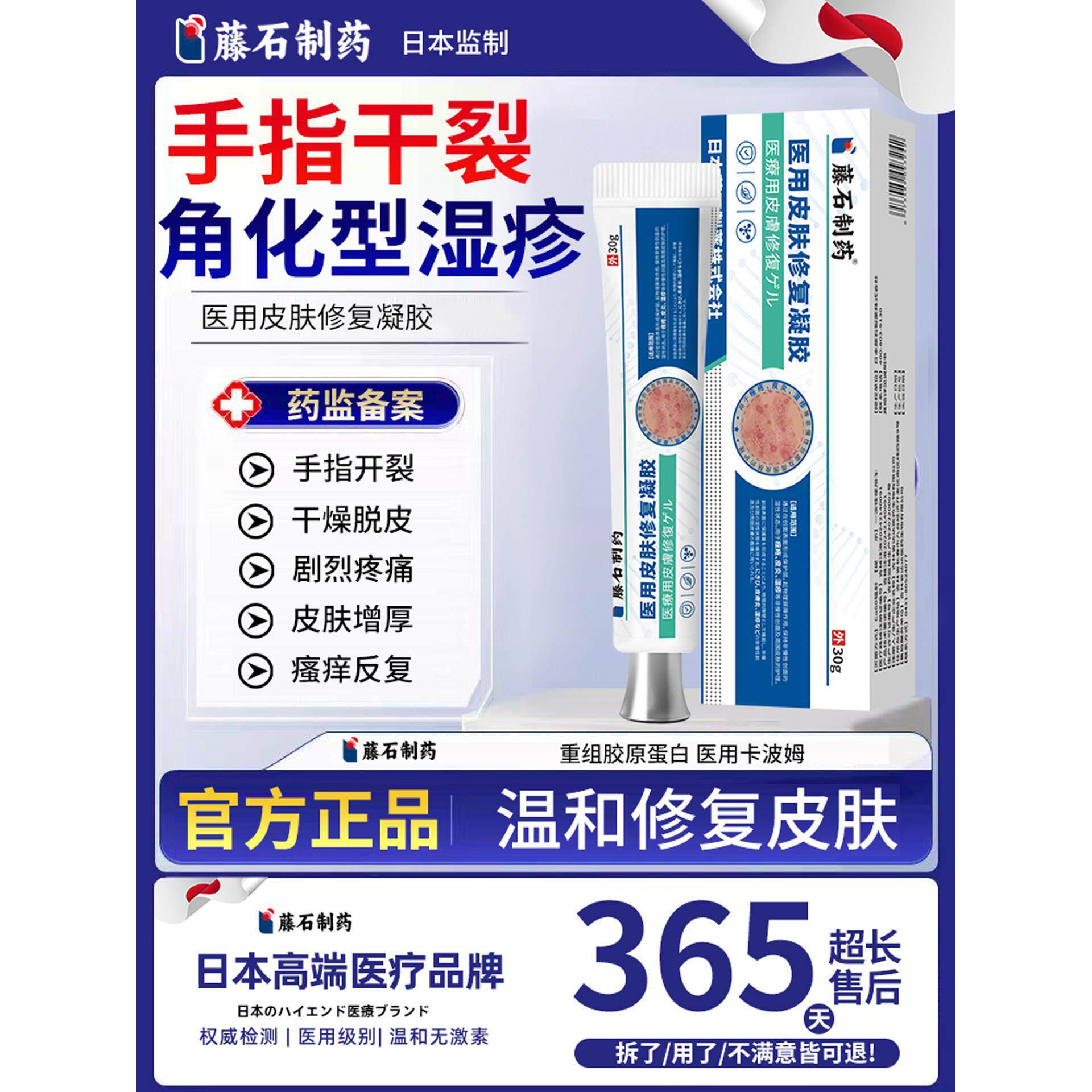 角化型手部湿疹癣膏脚增厚