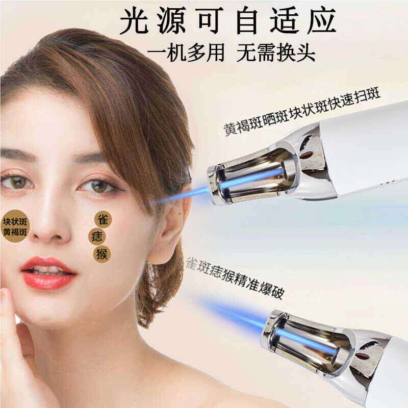 超皮祛斑仪器激光淡去痘秒