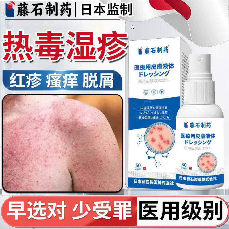 血热毒湿疹水泡身上长红斑