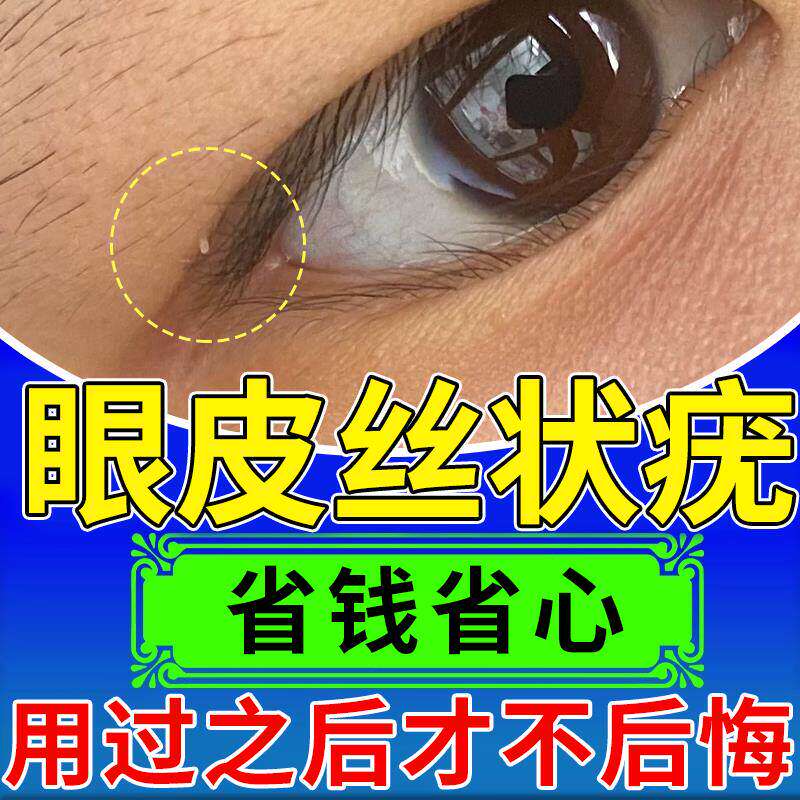 眼皮丝状疣睛脖子上长小肉