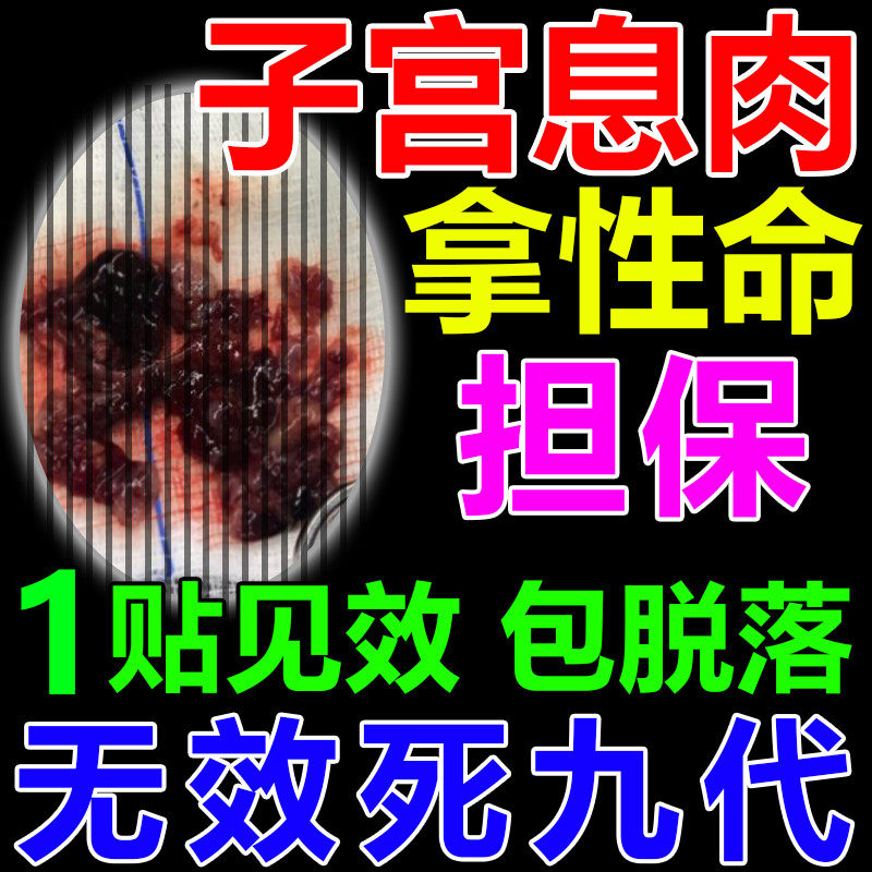 膜息肉药子宫腺肌症膜调理增厚异位专用贴