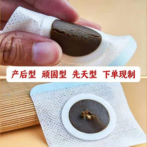 漢方减瘦脐贴古方熬制下单现制
