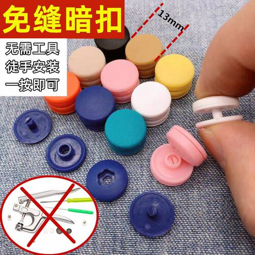 免工具免缝树脂四合扣宝宝隐形按