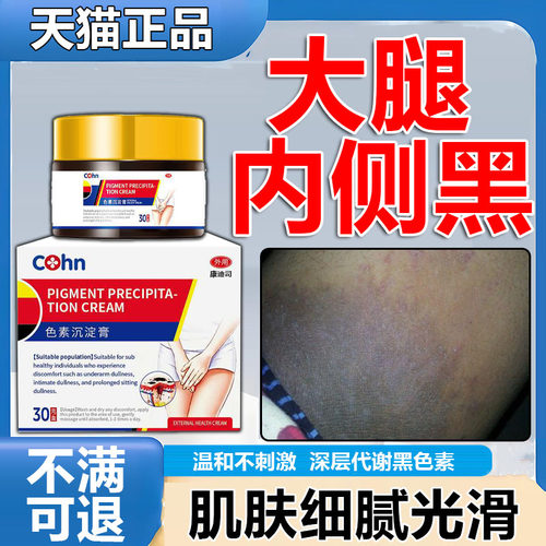 大腿内侧私密去黑印医用软膏