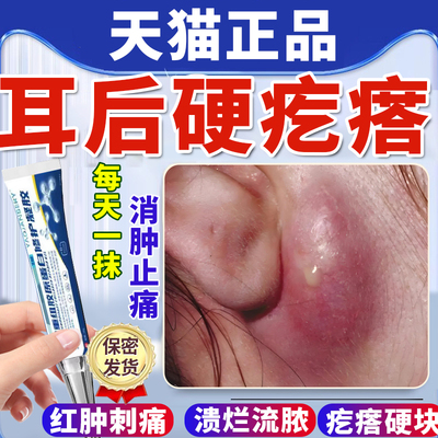 耳垂耳朵后面长疙瘩粉瘤皮脂腺囊肿疖肿硬块拔毒火疖子敷料贴膏u9