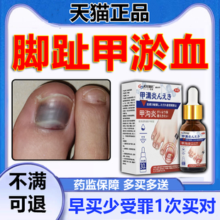 脚趾甲淤血脚趾砸伤淤青受伤淤血大拇指坏死指甲受损留脓出血疼p1