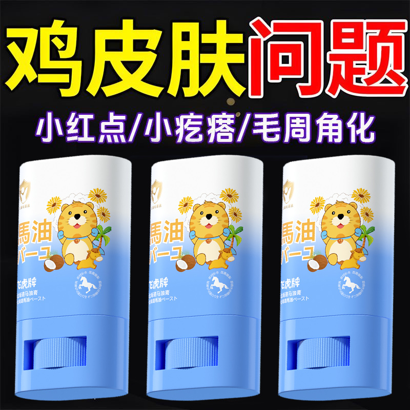 儿童青少年专用马油膏棒秋冬面霜宝宝干裂燥止痒身体乳滋润保湿