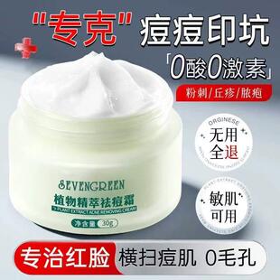 祛痘痘印痘坑修复膏凝露芦荟凝胶凹洞植物男女士淡化消去痘印痘疤