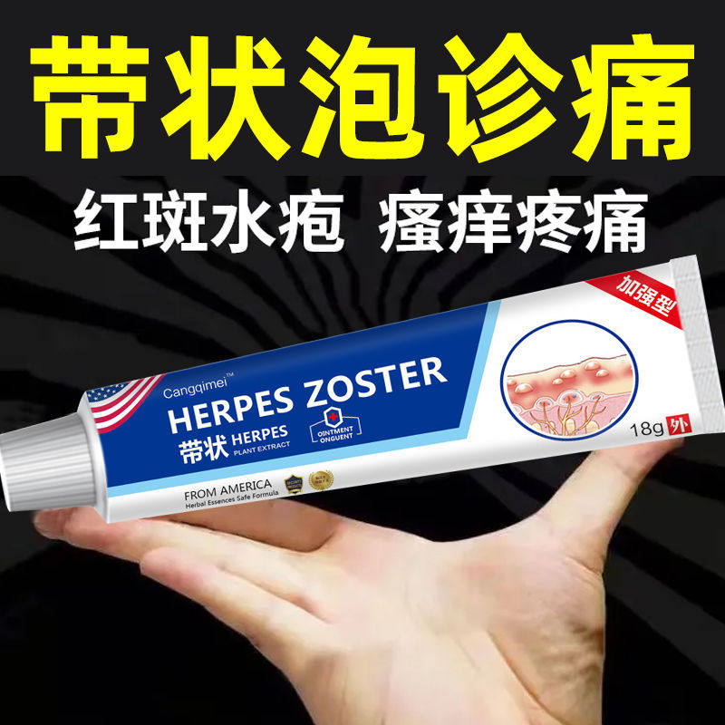 德国带状疱疹后遗症神经痛特效外专用膏断蛇缠腰快速止痛正品克星