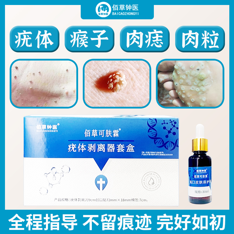 丝状疣肉粒疣瘊包去除无用退全款