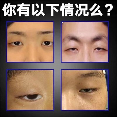 极速眼皮下垂提拉贴双眼皮神器去肿定型上眼睑R用提拉紧致防松弛