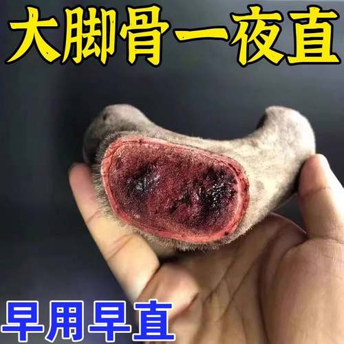 极速不满可褪】大脚骨脚趾重叠专C用膏贴拇外翻神器拇指外翻矫正