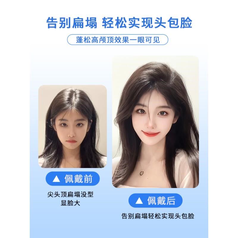 假发片女头顶补发l蓬松真发垫发根增发量神器高颅顶垫发片全真图片