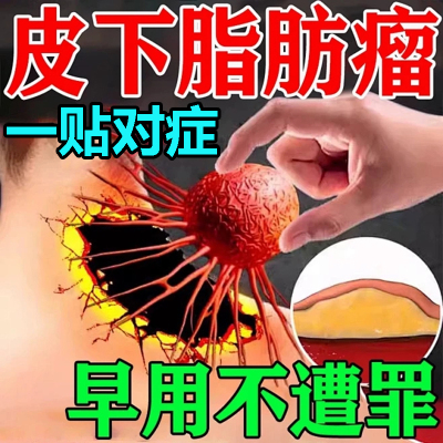 皮肤纤维瘤非去除药膏皮下软硬