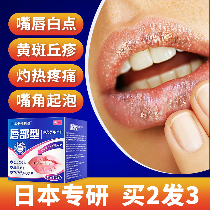 皮脂腺异位症嘴唇白点脂肪小颗粒口角炎烂嘴角开裂嘴巴脂肪粒膏药