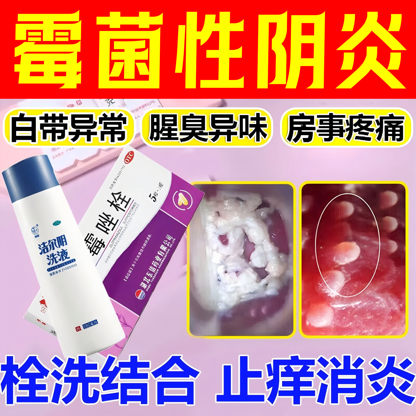【妍婷】克霉唑栓150mg*10枚/盒