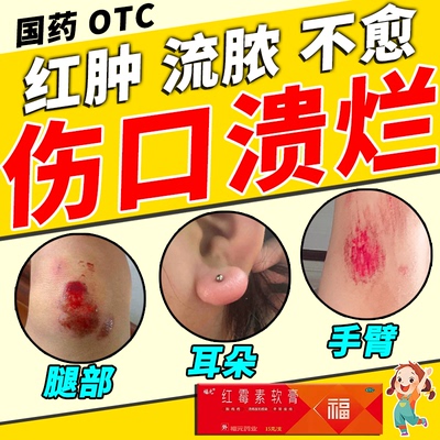 【福元】红霉素软膏1%*15g*1支/盒