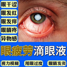 眼药水止痒消炎杀菌眼睛干涩抗疲劳缓解视疲劳模糊老年人红血丝