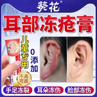 冻疮膏儿童止痒冻伤药膏耳朵脸部防冻裂特成人正品官方旗舰店效