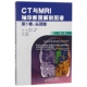 第1卷头颈部第4版 CT与MRI袖 珍断层解剖图谱