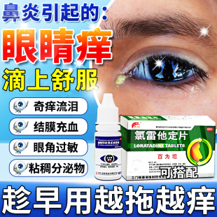 过敏性鼻炎眼睛痒滴眼液结膜炎儿童成人抗过敏止痒眼药水眼干杀菌