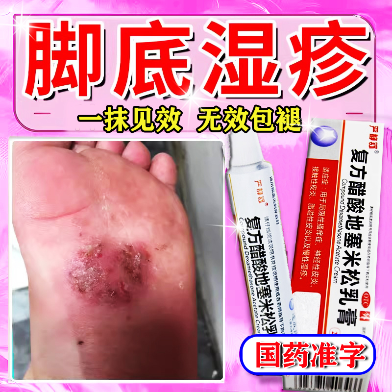 【严静舒】复方醋酸地塞米松乳膏20g*1支/盒
