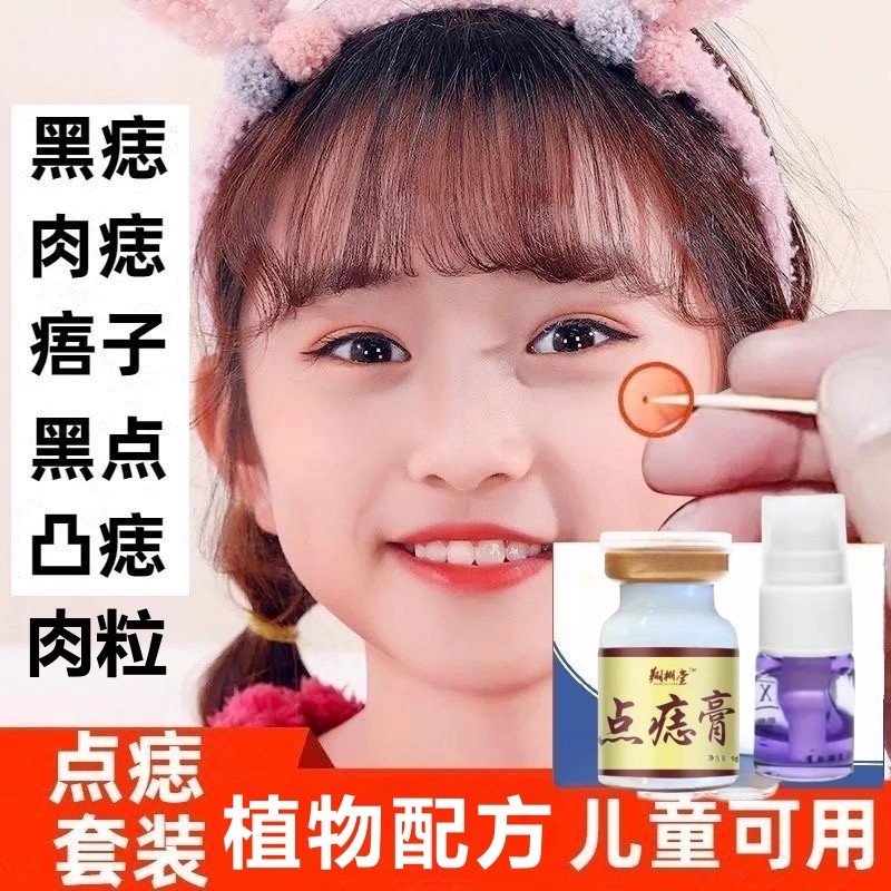 【美容院同款】官方正品黑点黑志肉志凸志痦子