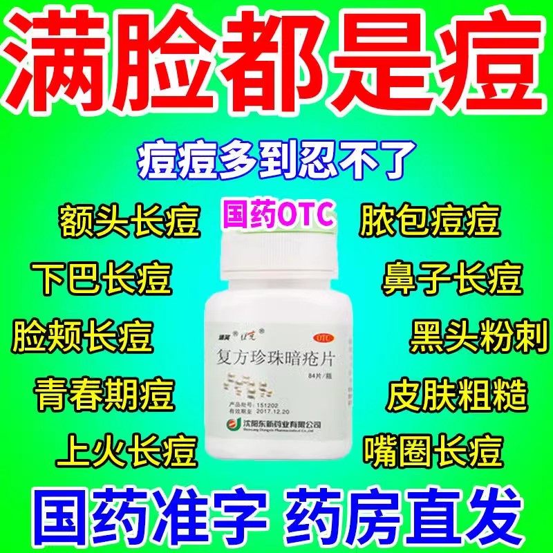 复方珍珠暗疮片正品治女性脸部座疮粉刺疙瘩脓包青春痘消斑祛痘AE