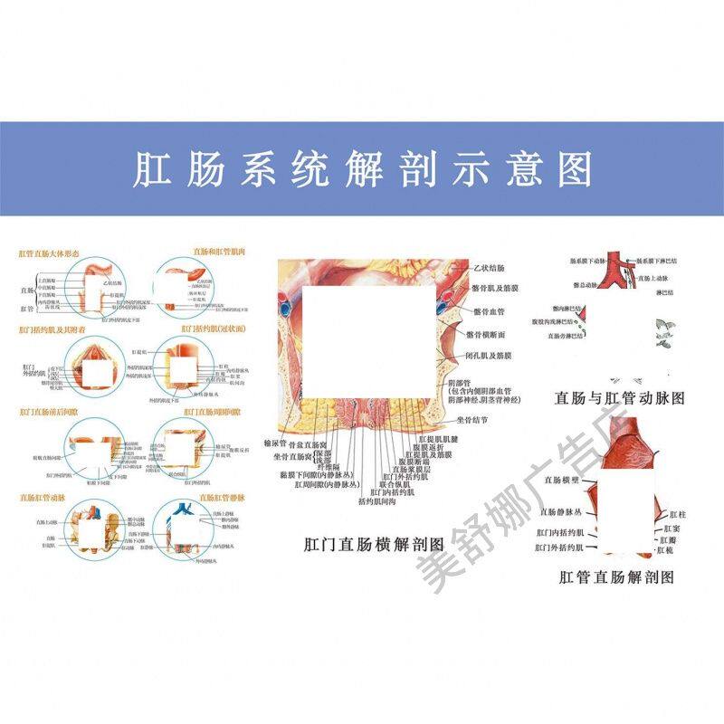 肛肠常见痔疮疾病图例墙贴纸肛肠科医院贴纸挂图宣传海报装饰画