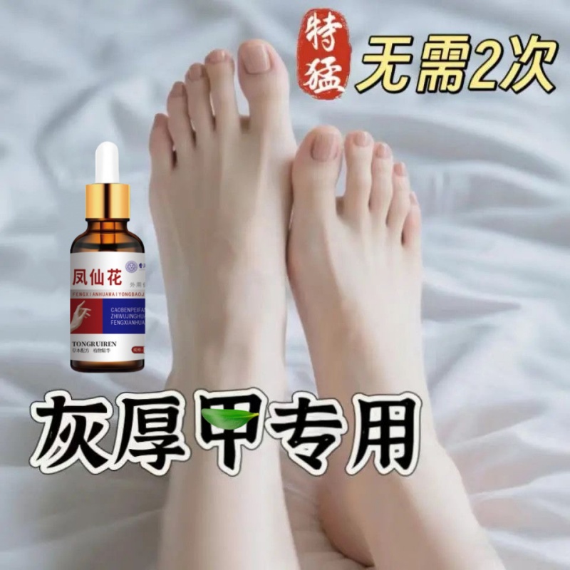 【屈臣氏今年很火】坏钾变好钾 手指脚趾修复变好钾 男女通用