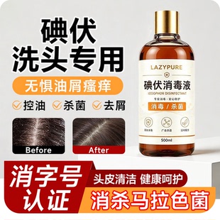 碘伏洗发水去屑痒痒舒缓控油抑菌洗头发专用消毒液头皮毛囊清洗¥