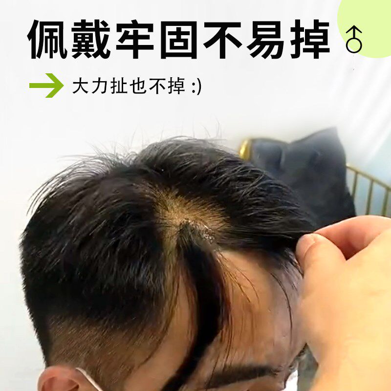 发际线鬓角假发贴男士前额补发隐形m型一片式真发贴刘海额角假发