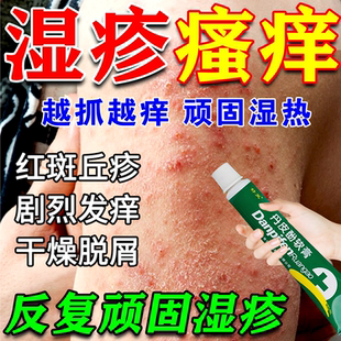 丹皮酚软膏正品湿疹止痒根去外用顽固皮炎皮肤瘙痒止痒特新效药膏