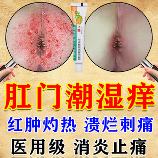 氢化可的松乳膏官方旗舰店肛门瘙痒特药效肛周专用湿疹去看根潮湿
