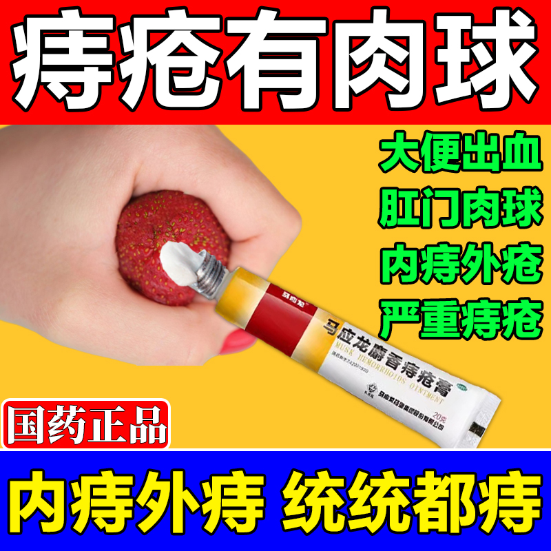马应龙痔疮膏正品官方旗舰店内外痔疮消肉球瘙痒血便脱肛男女通用