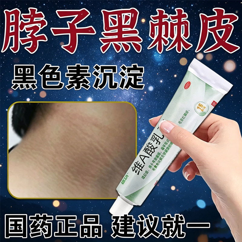 去脖子黑棘皮病药膏私处腋下胳膊肘去黑皮肤黑色素沉淀去除医用型