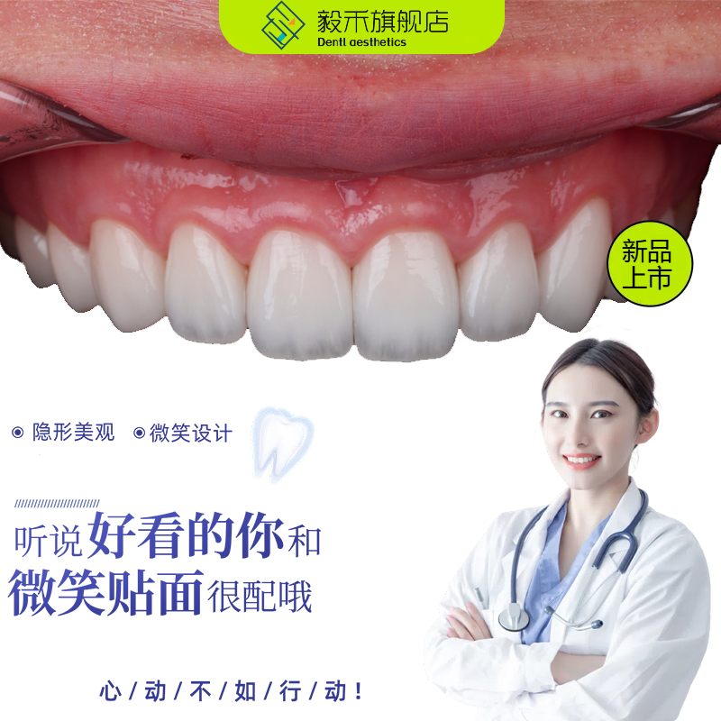 美白牙齿全瓷贴面改善牙齿