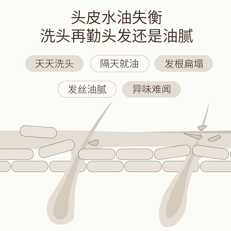 菲诗蔻头皮护理精华液油控油保湿敏感修护舒缓清爽女护发免洗安瓶