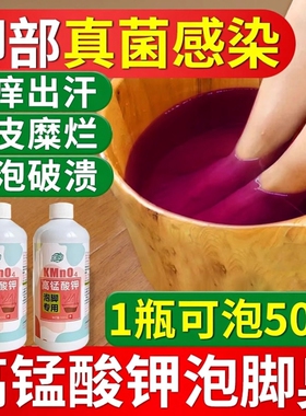 高锰酸钾泡脚溶液除臭粉脱皮杀菌除痒水泡烂脚丫片水真菌克星